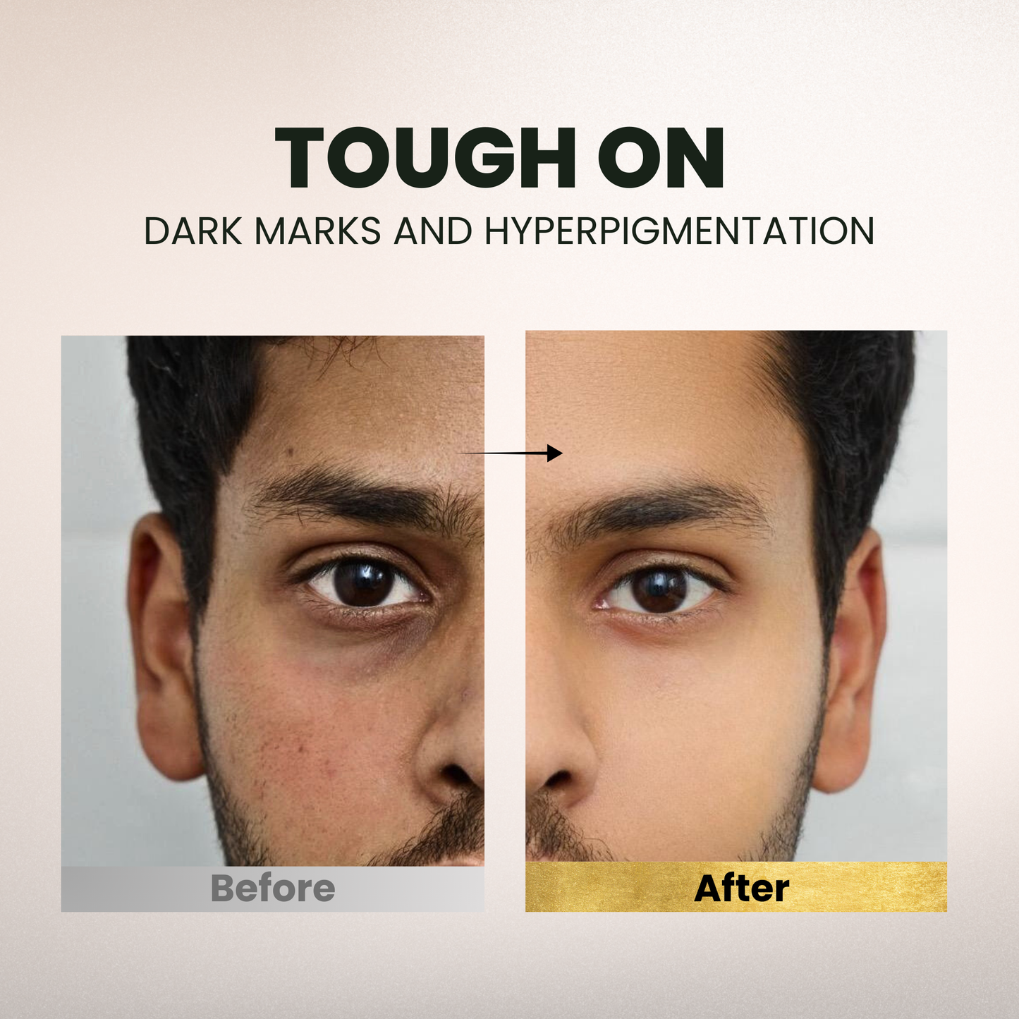 Tea Tree + Glycolic Acid Clarifying Face Wash