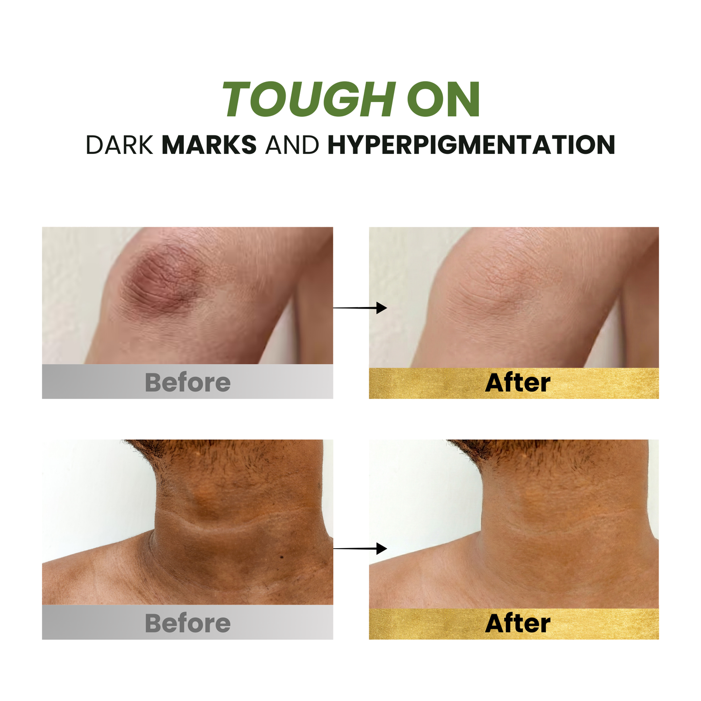 Tea Tree + Glycolic Acid Refreshing Body Wash