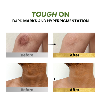 Tea Tree + Glycolic Acid Refreshing Body Wash